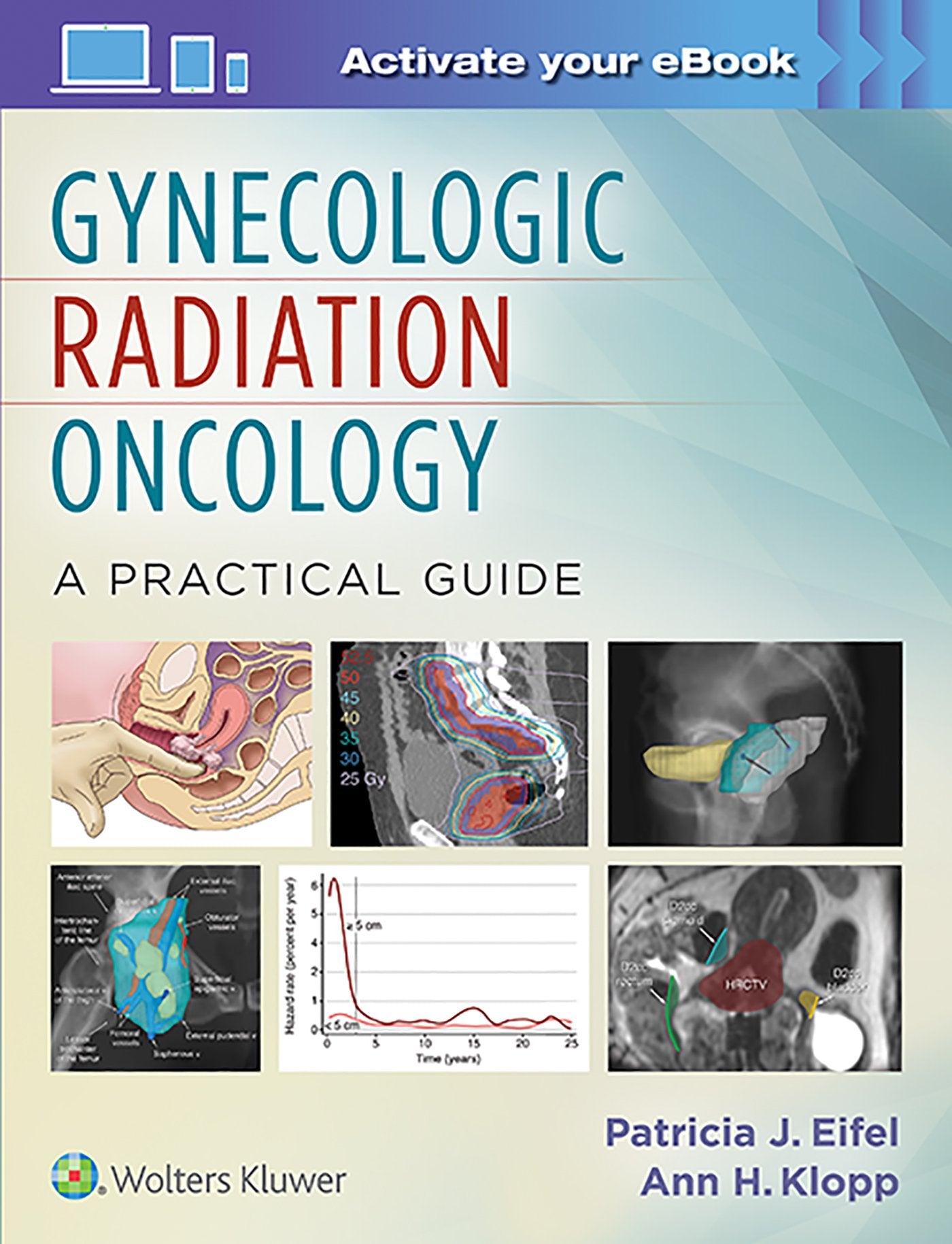 Gynecologic Radiation Oncology — used book cover
