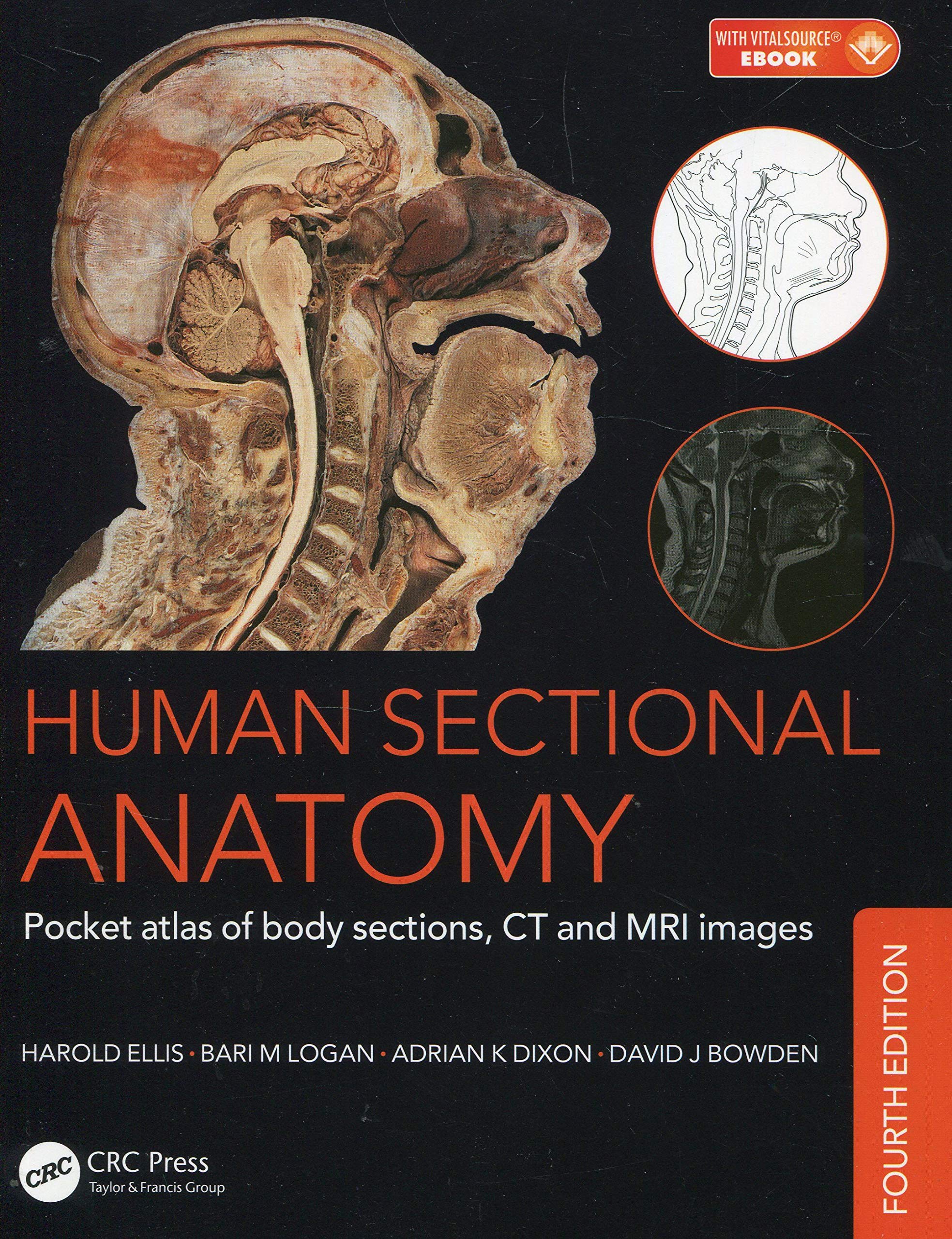 Human Sectional Anatomy: Pocket atlas of body sections, CT and MRI images, Fourth edition