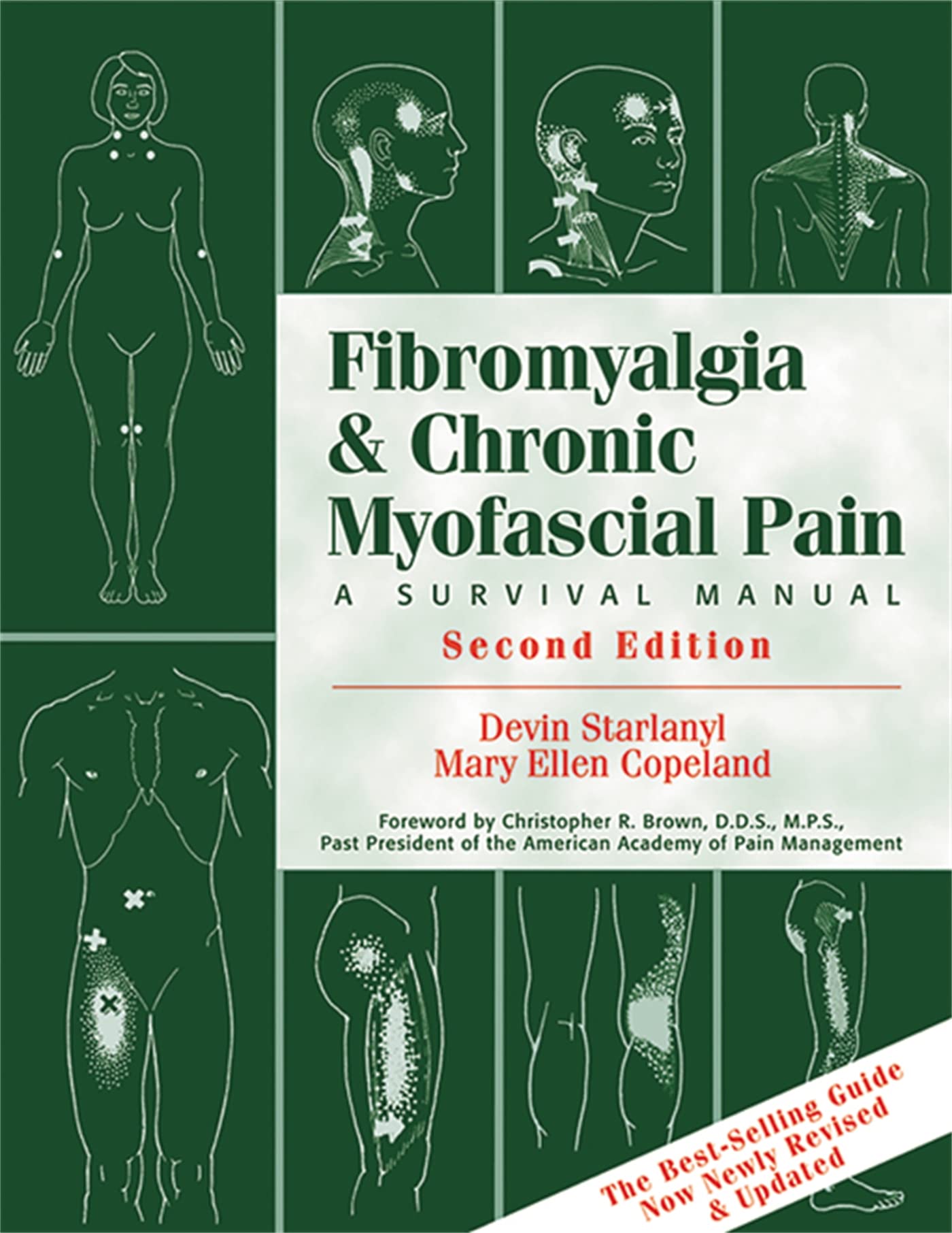 Fibromyalgia and Chronic Myofascial Pain — used book cover