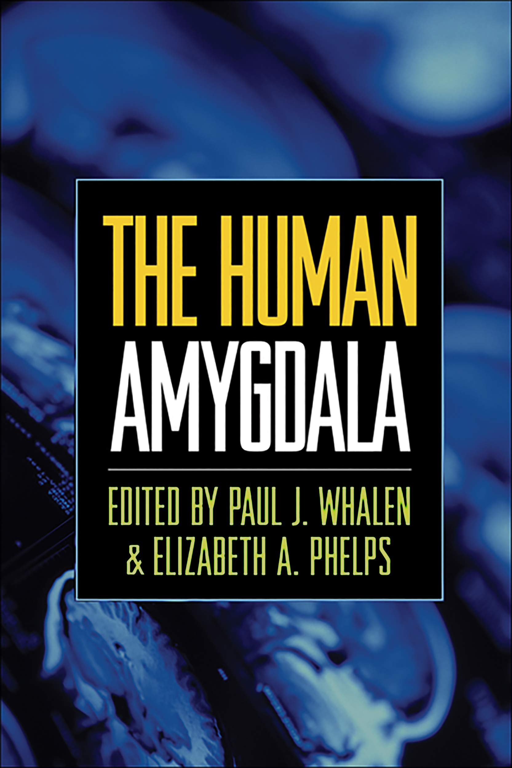 The Human Amygdala — used book cover