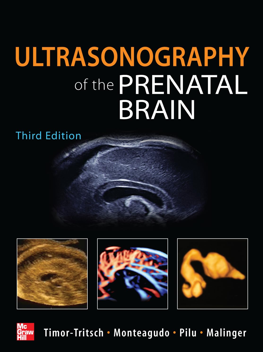 Ultrasonography of the Prenatal Brain, Third Edition — used book cover