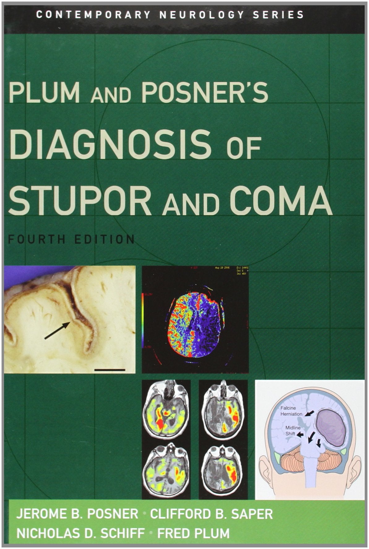 Plum and Posner&