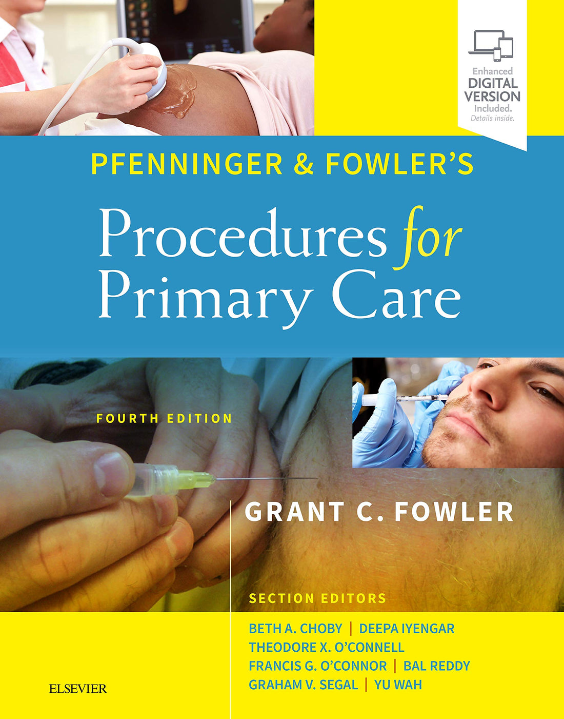 Pfenninger and Fowler&