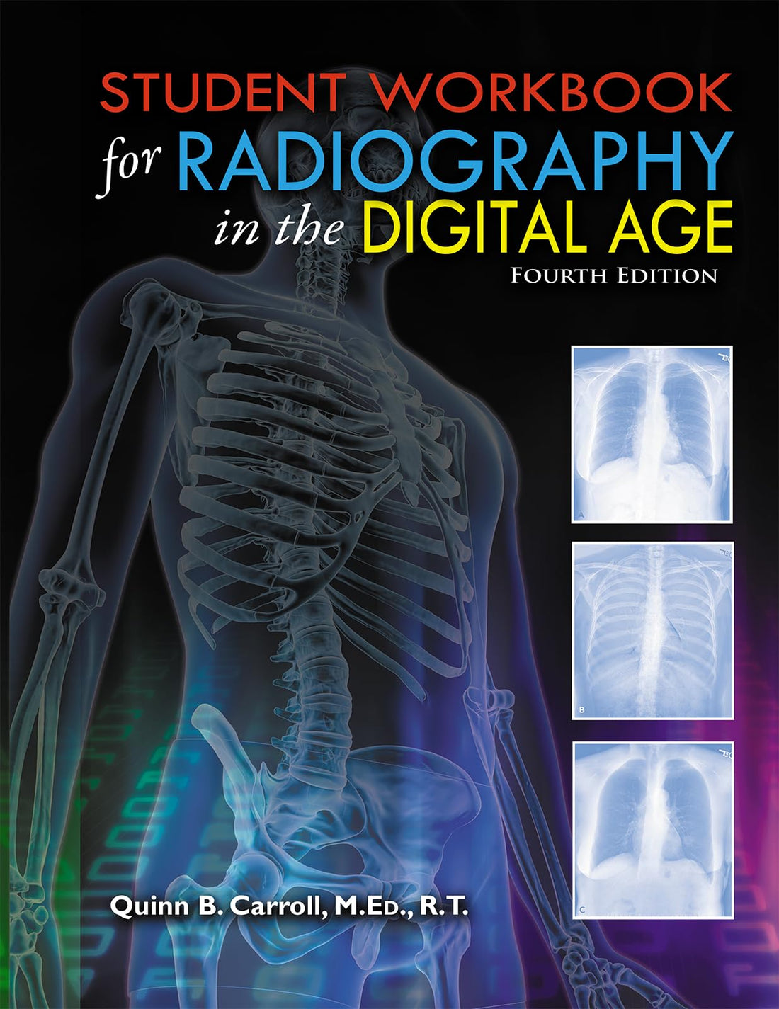 Radiography in the Digital Age
