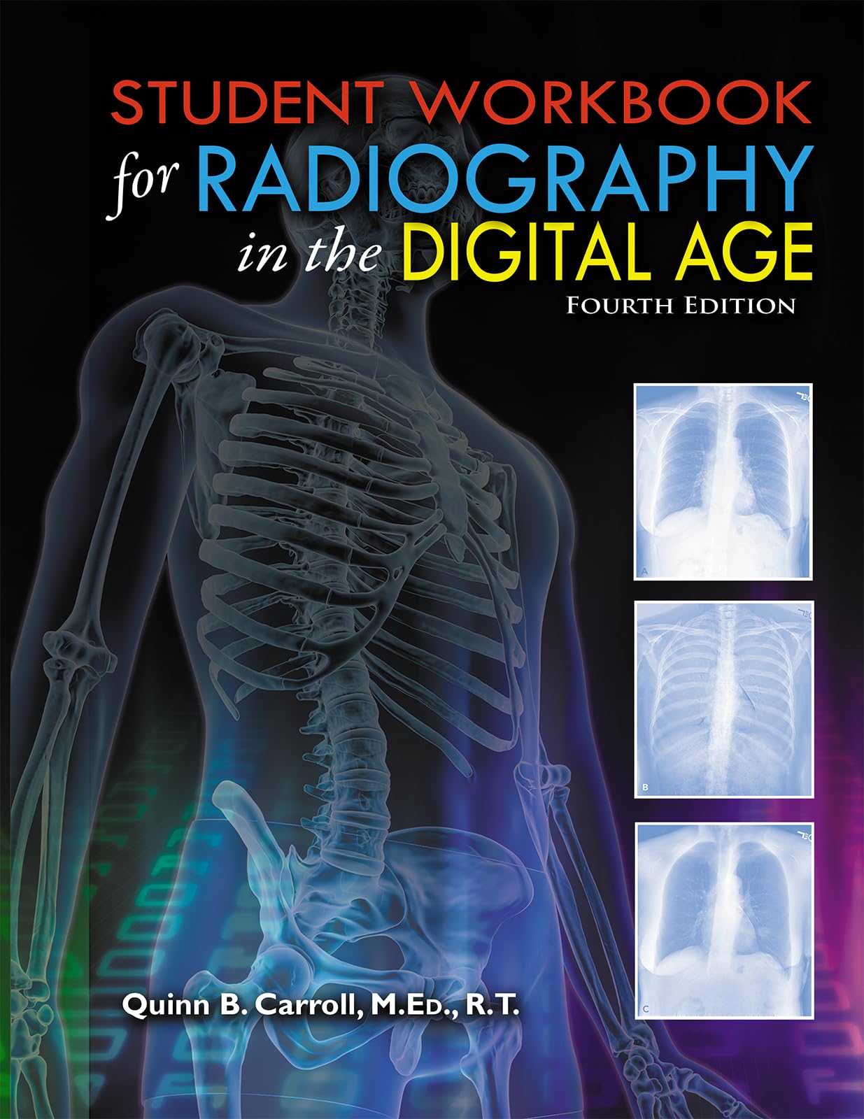 Radiography in the Digital Age