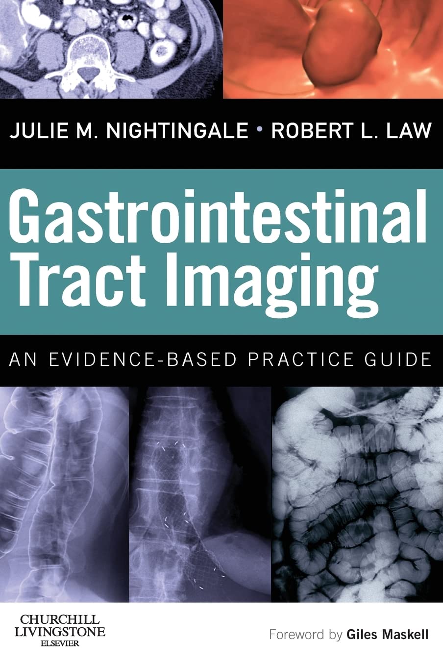 Gastrointestinal Tract Imaging: An Evidence-Based Practice Guide