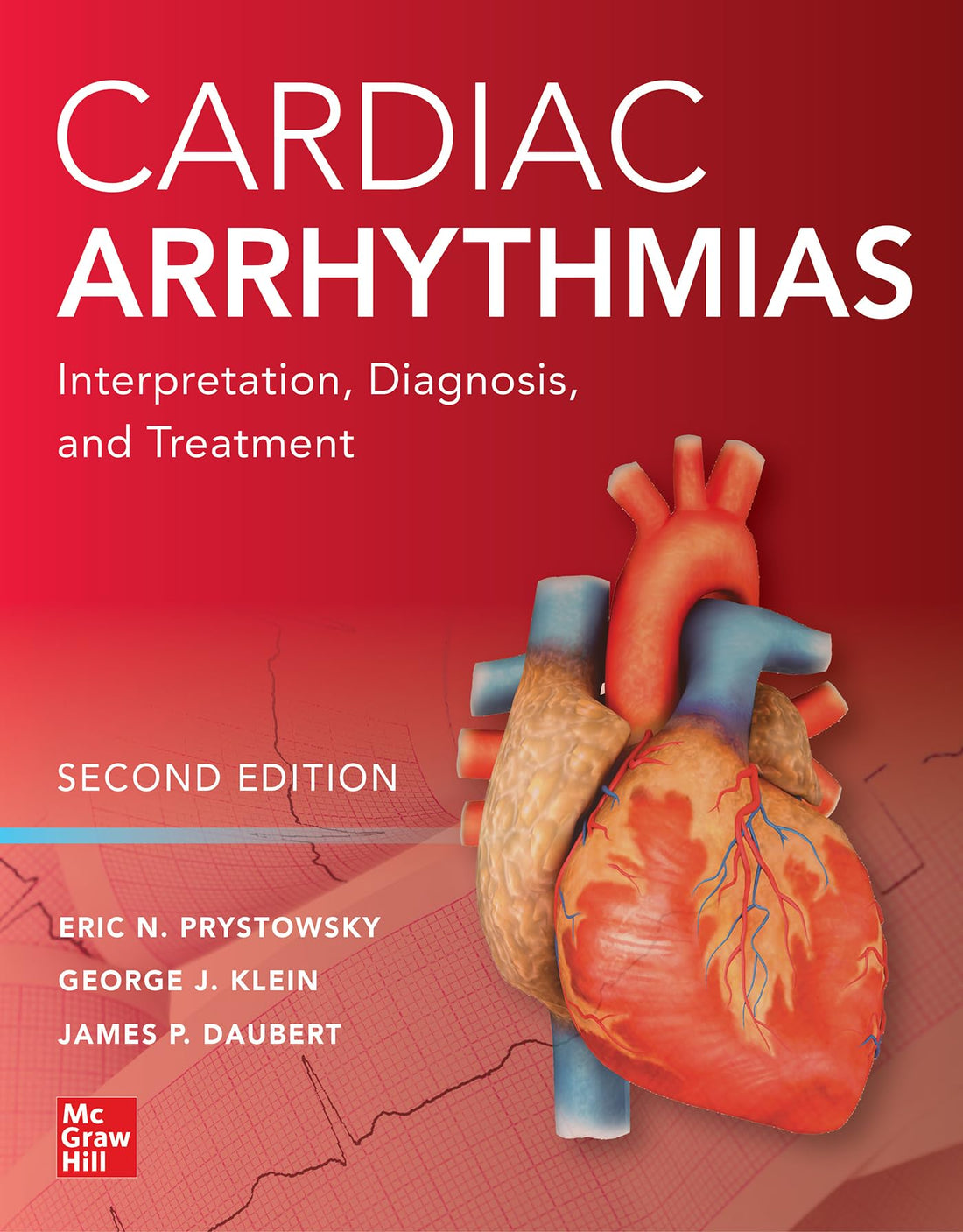Cardiac Arrhythmias: Interpretation, Diagnosis and Treatment, Second Edition — used book cover
