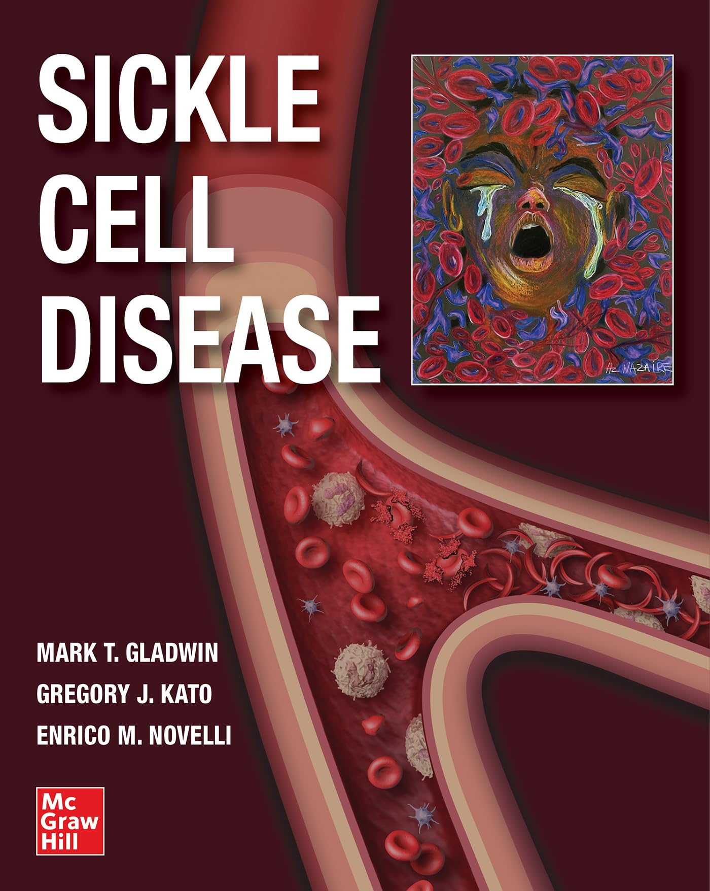 Sickle Cell Disease — used book cover