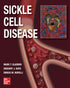 Sickle Cell Disease — used book cover
