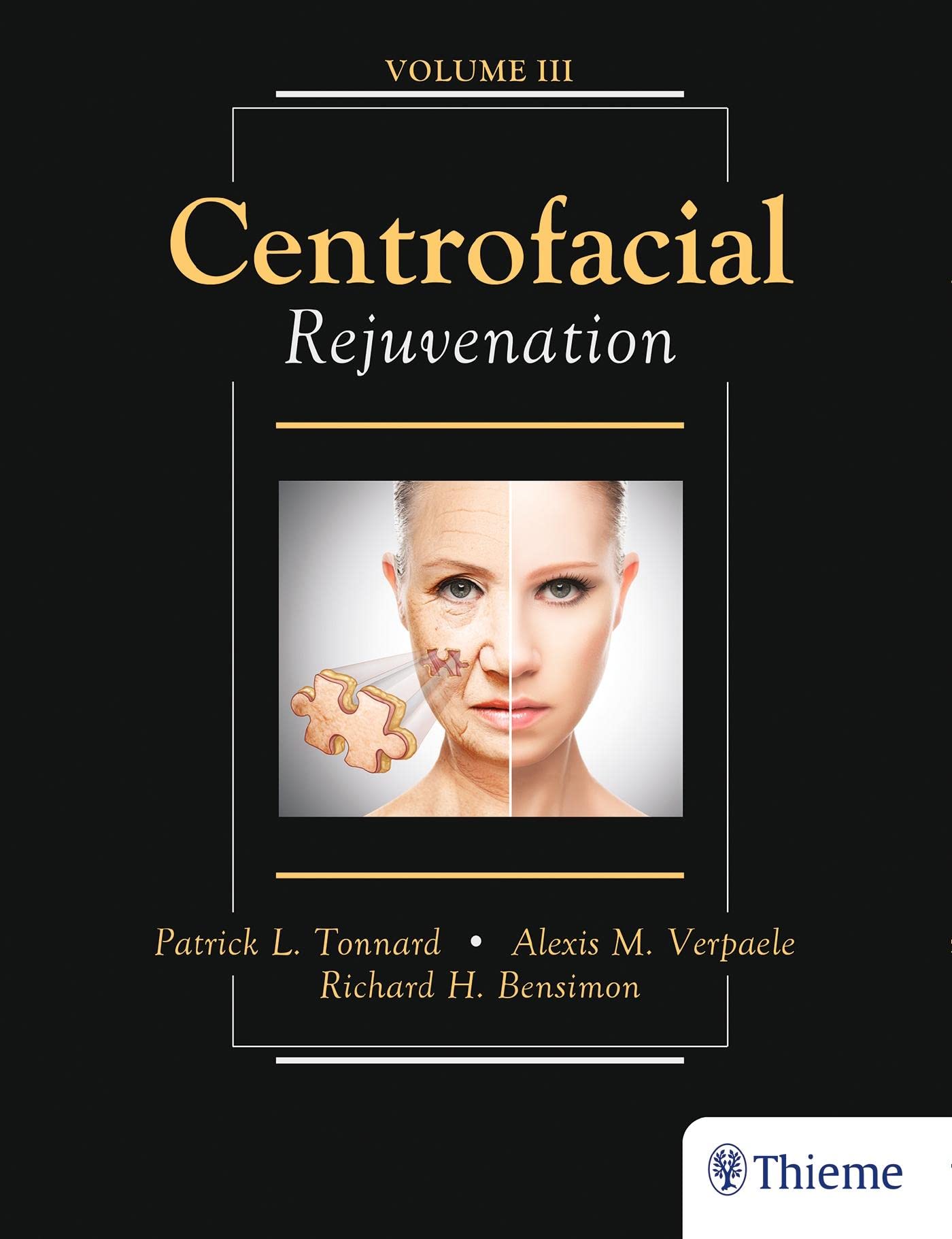 Centrofacial Rejuvenation — used book cover