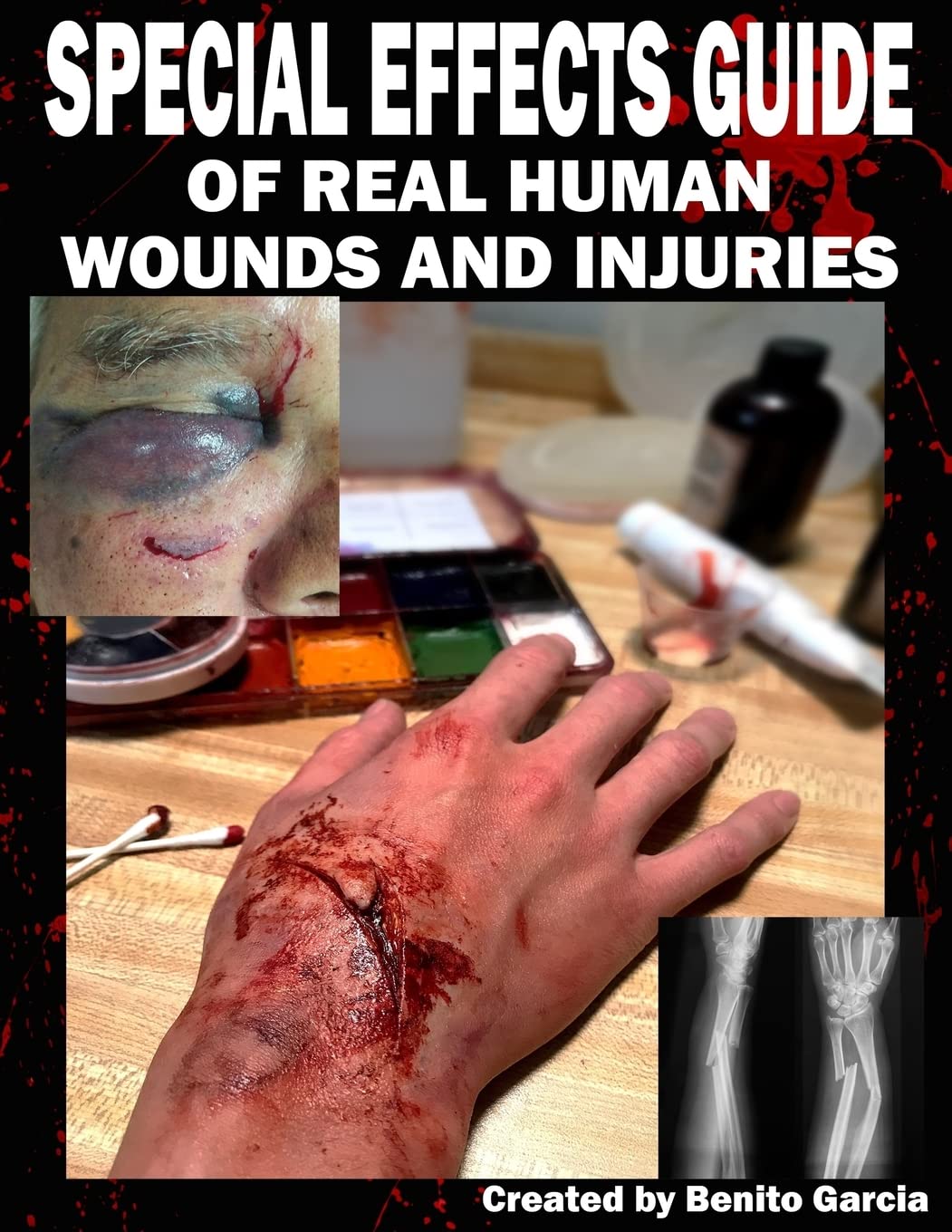 Special Effects Guide Of Real Human Wounds and Injuries — used book cover