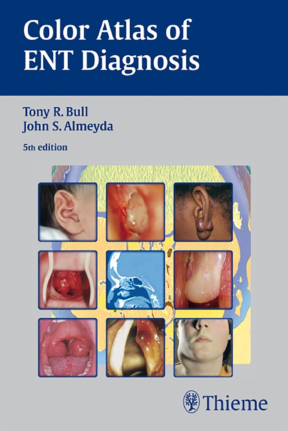 Color Atlas of ENT Diagnosis