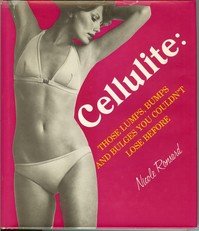 Cellulite: those lumps, bumps, and bulges you couldn&